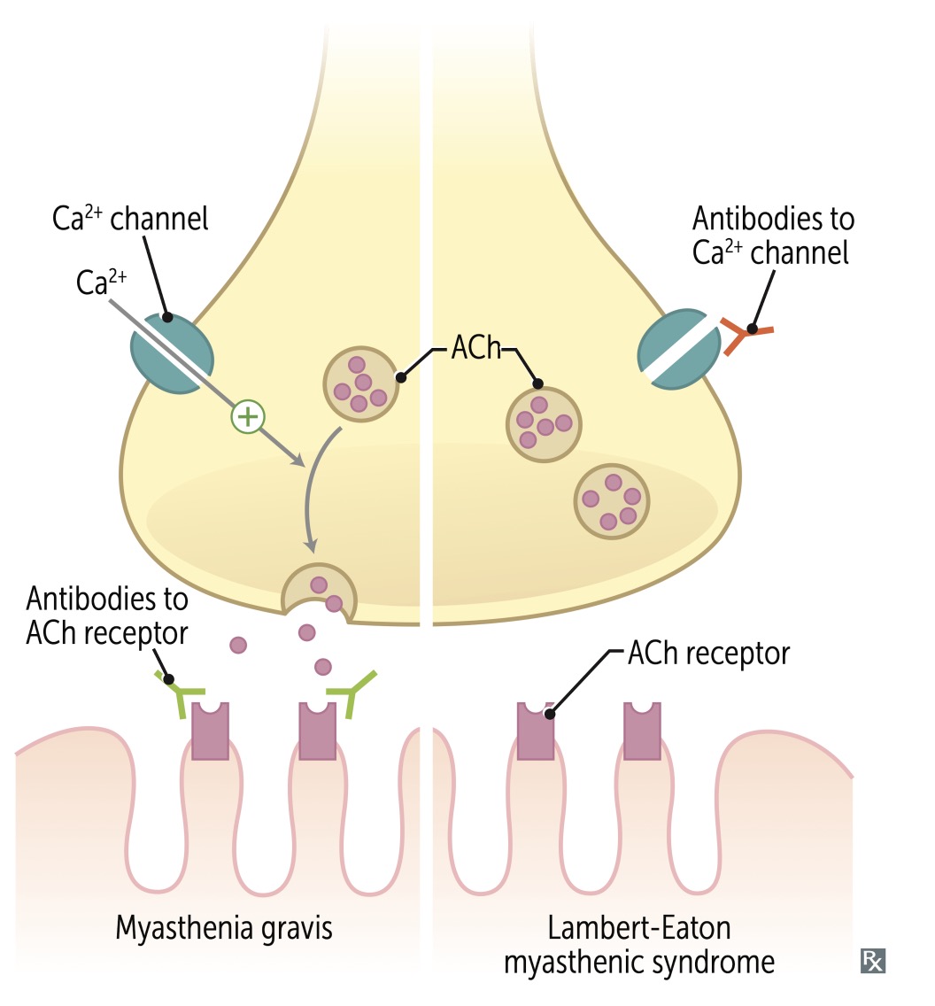 Lambert-Eaton Syndrome